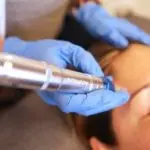 Package of 3 Microneedling Facial Rejuvenation